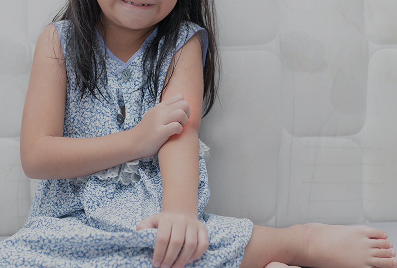 The safety and tolerability profile of bilastine for chronic urticaria in children